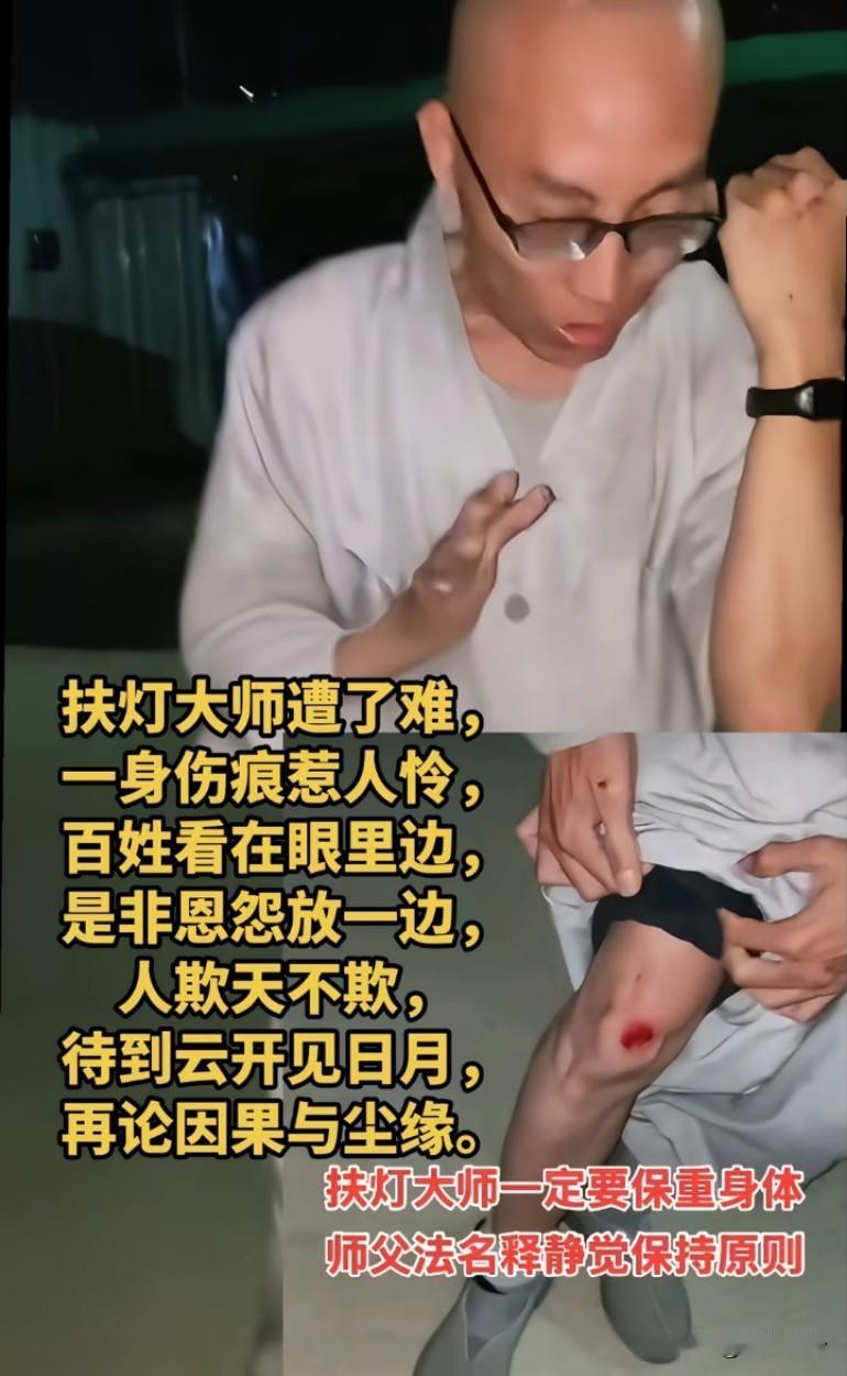 扶灯大师脸上腿上都是伤，认清龙树邪教的本质，早日脱坑吧！
刧后余生，以后千万不要
