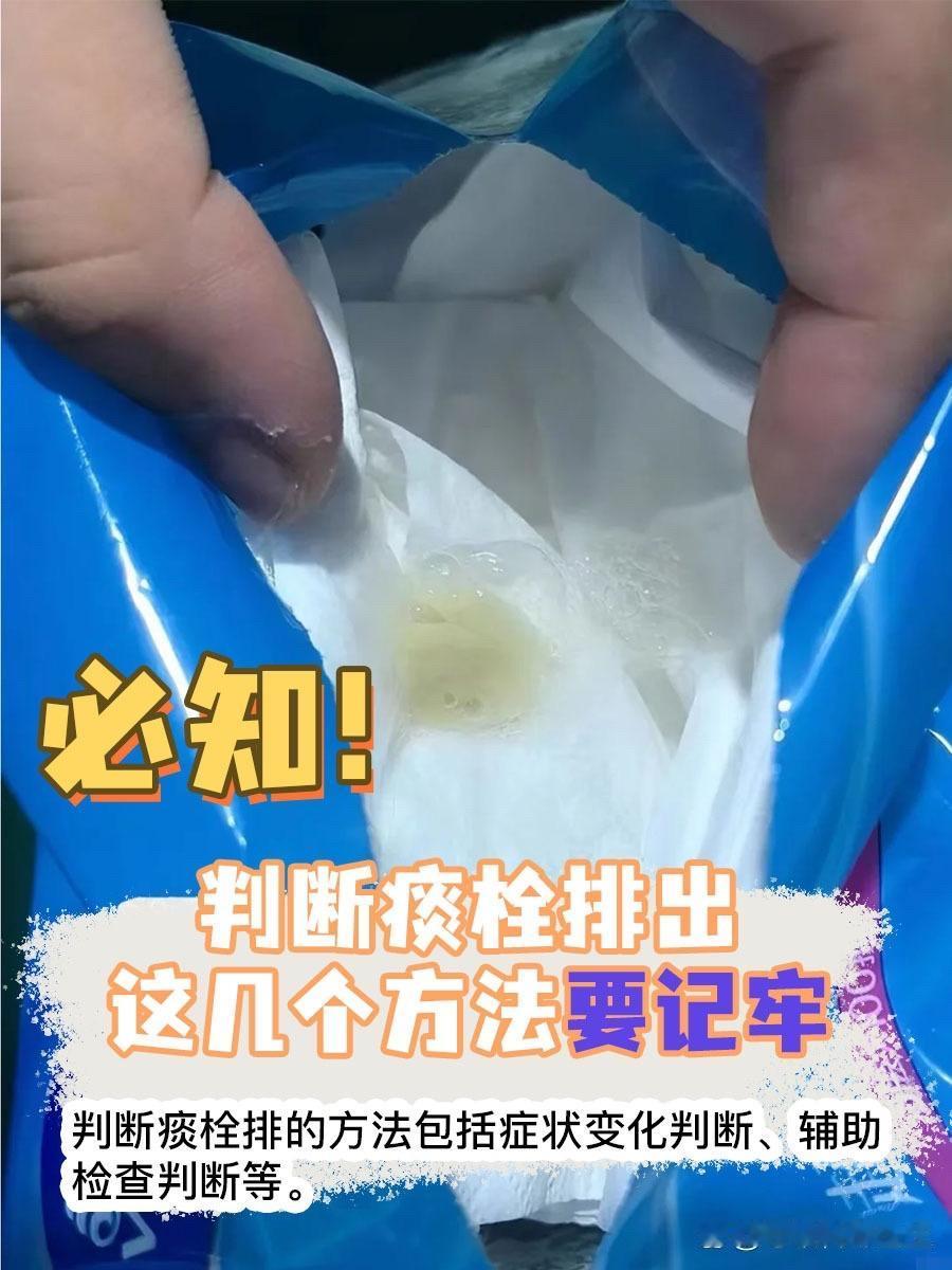 甲流咳痰不利，这些辅助方法用过吗？甲流 咳痰