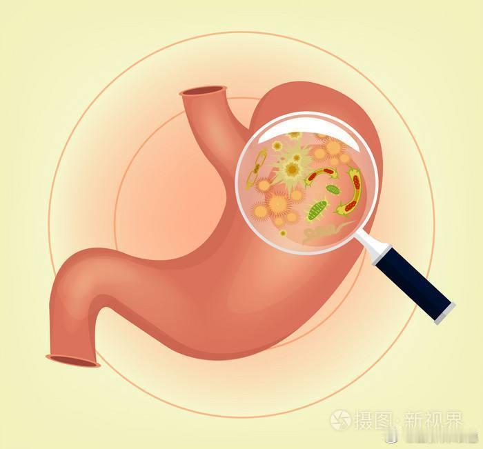 #28岁女子经常饥一顿饱一顿确诊胃癌##健闻登顶计划# 饥一顿饱一顿和胃癌并没有
