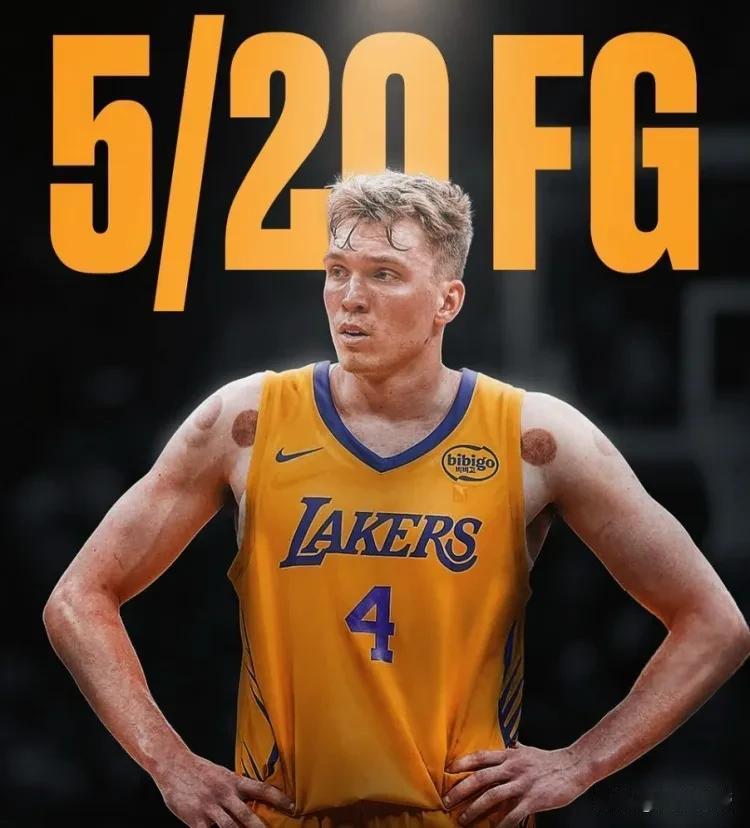夏天白练了，克内克特夏季联赛2场比赛合计20投仅中5！

在今天湖人与热火的夏季