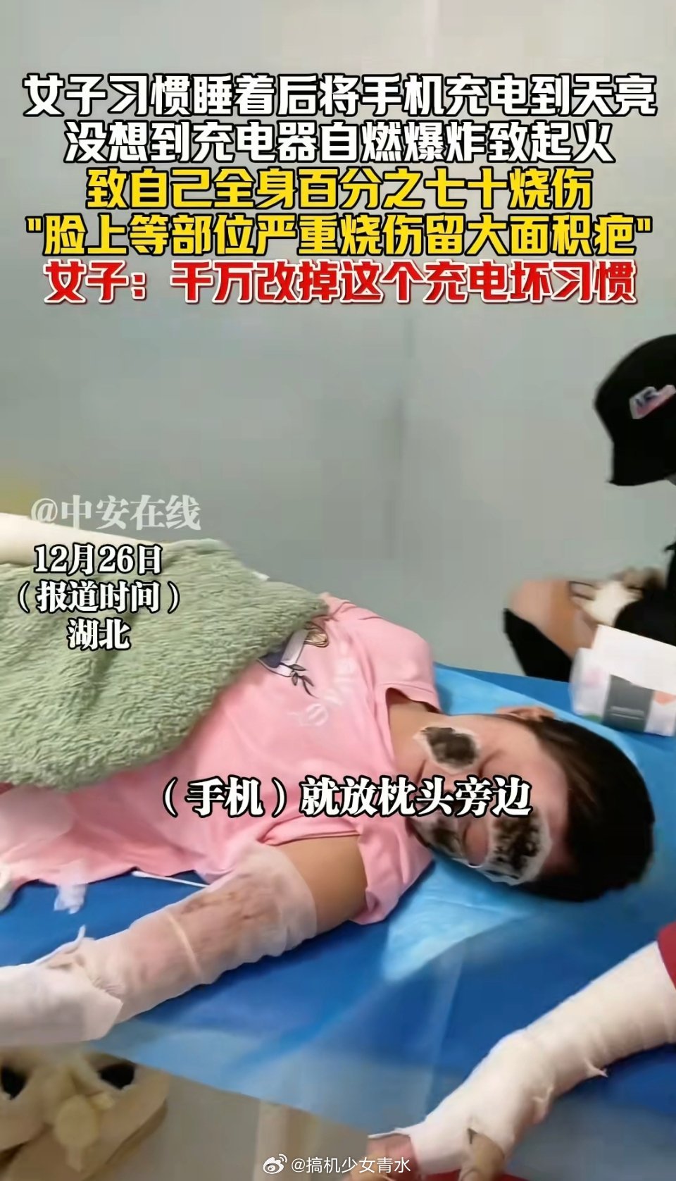 女子彻夜充电致全身70%烧伤用的什么手机啊？现在的安卓机基本上都是温度高会停充的