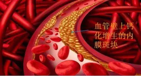 现代医学与血栓：为何不能提前溶栓？

随着现代医学的飞速发展，我们对抗血栓的能力