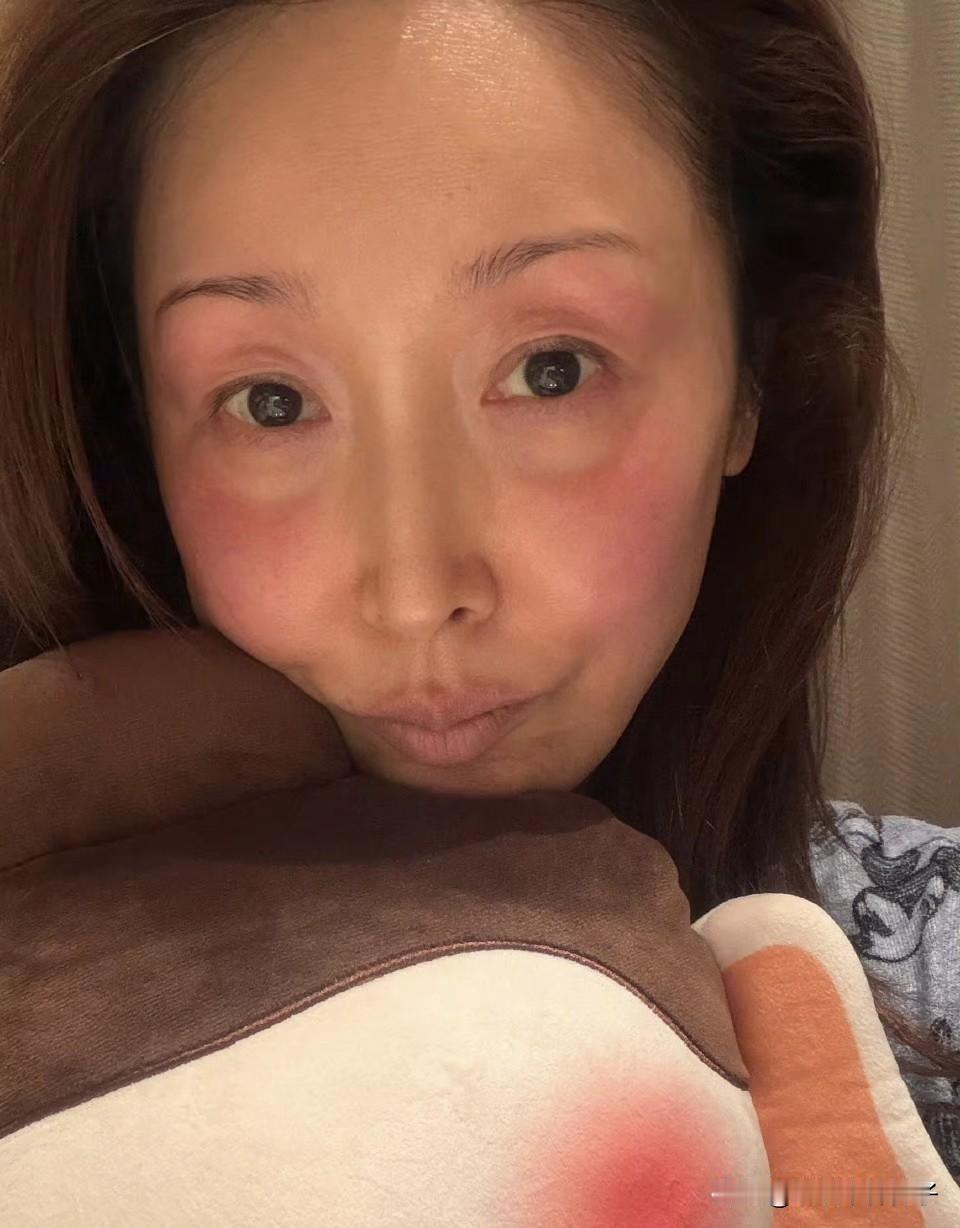 歌手孙悦录春晚，把脸冻伤了！
1月21日，歌手孙悦在社交平台晒出一组素颜照，一看