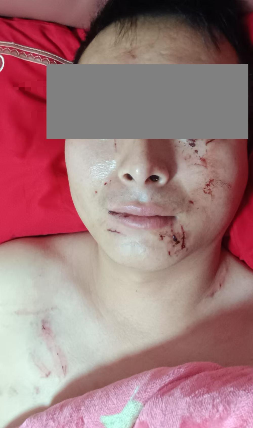 新婚夜男子被新娘殴打，半年后发现妻子患精神病起诉离婚退还11万彩礼，竟被法院驳回