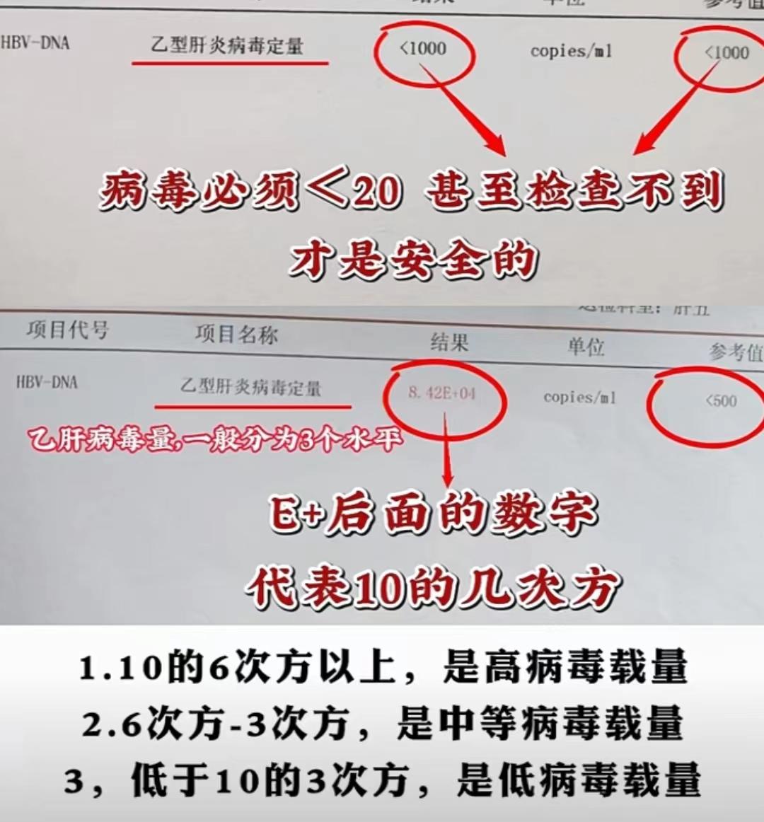 乙肝病毒量＜500，真的安全吗？