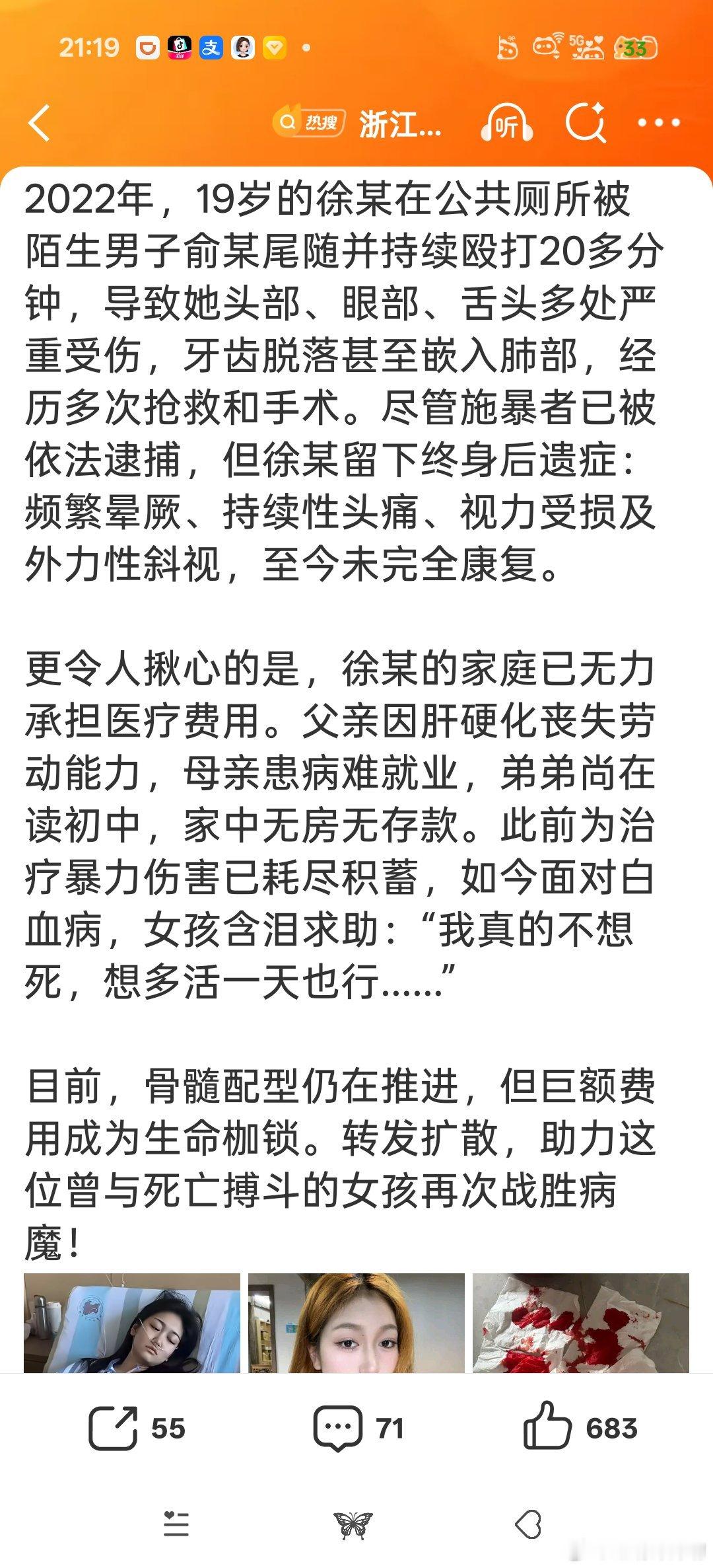 这女孩太惨了！！！打人者没有进行经济赔偿吗？