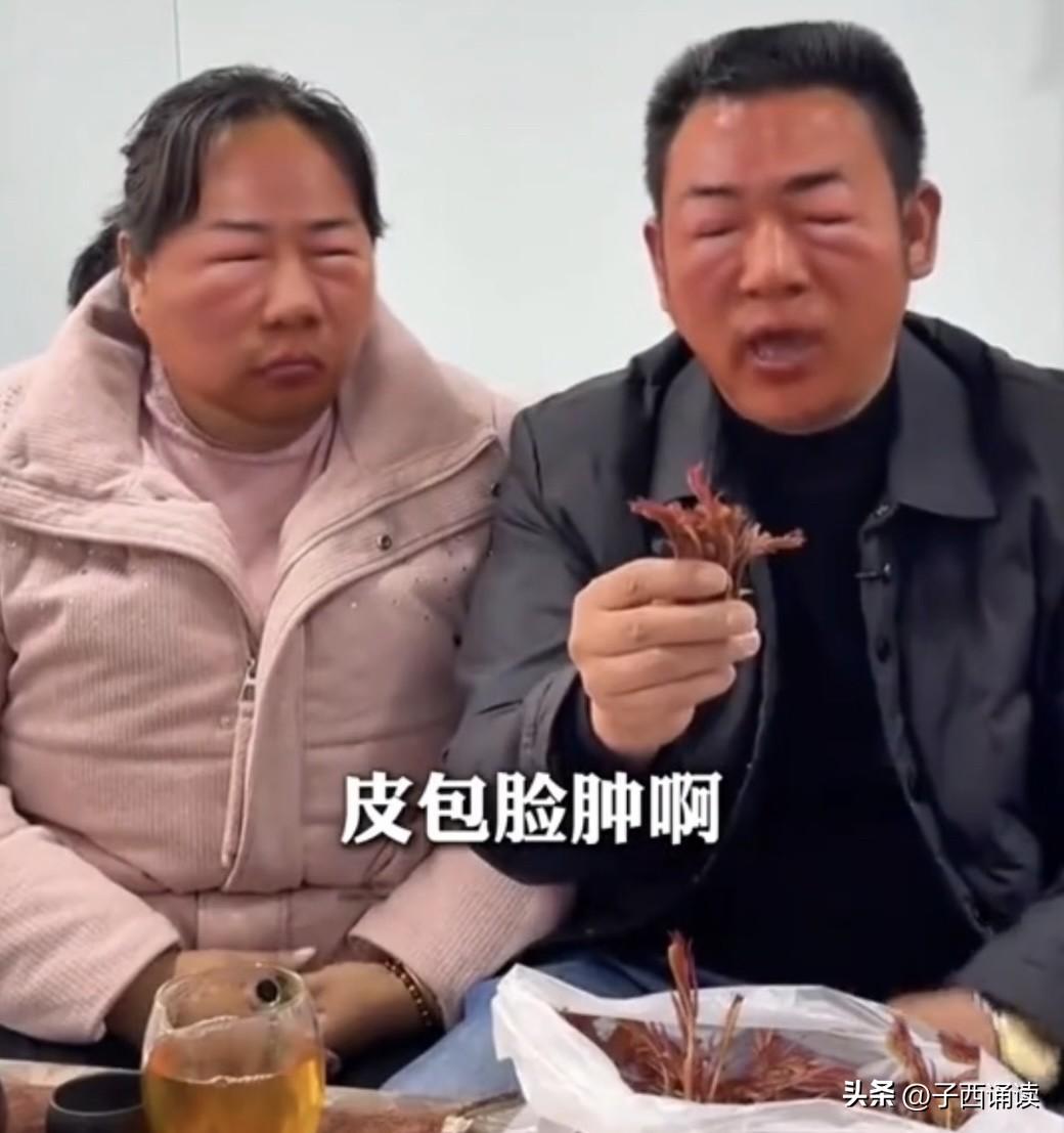 当心！误把漆树芽当香椿，脸肿得像被马蜂蜇过，可笑又可叹！