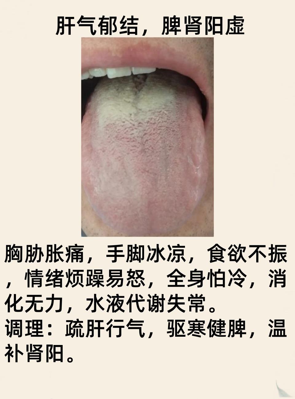 朋友们，大家好啊，我是中医张佩江，今天是舌诊挑战19天。
最近看舌头的朋友，越来