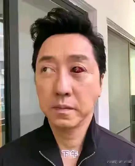 天哪！庾澄庆眼睛怎么了？
看着好恐怖、好吓人啊！
他这是怎么了？