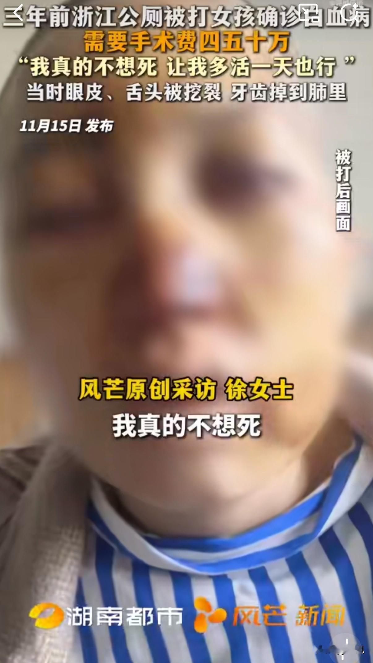 那个在公厕被暴打的女孩，现在又躺在了白血病的病床上，命运对她太残酷了。

三年前