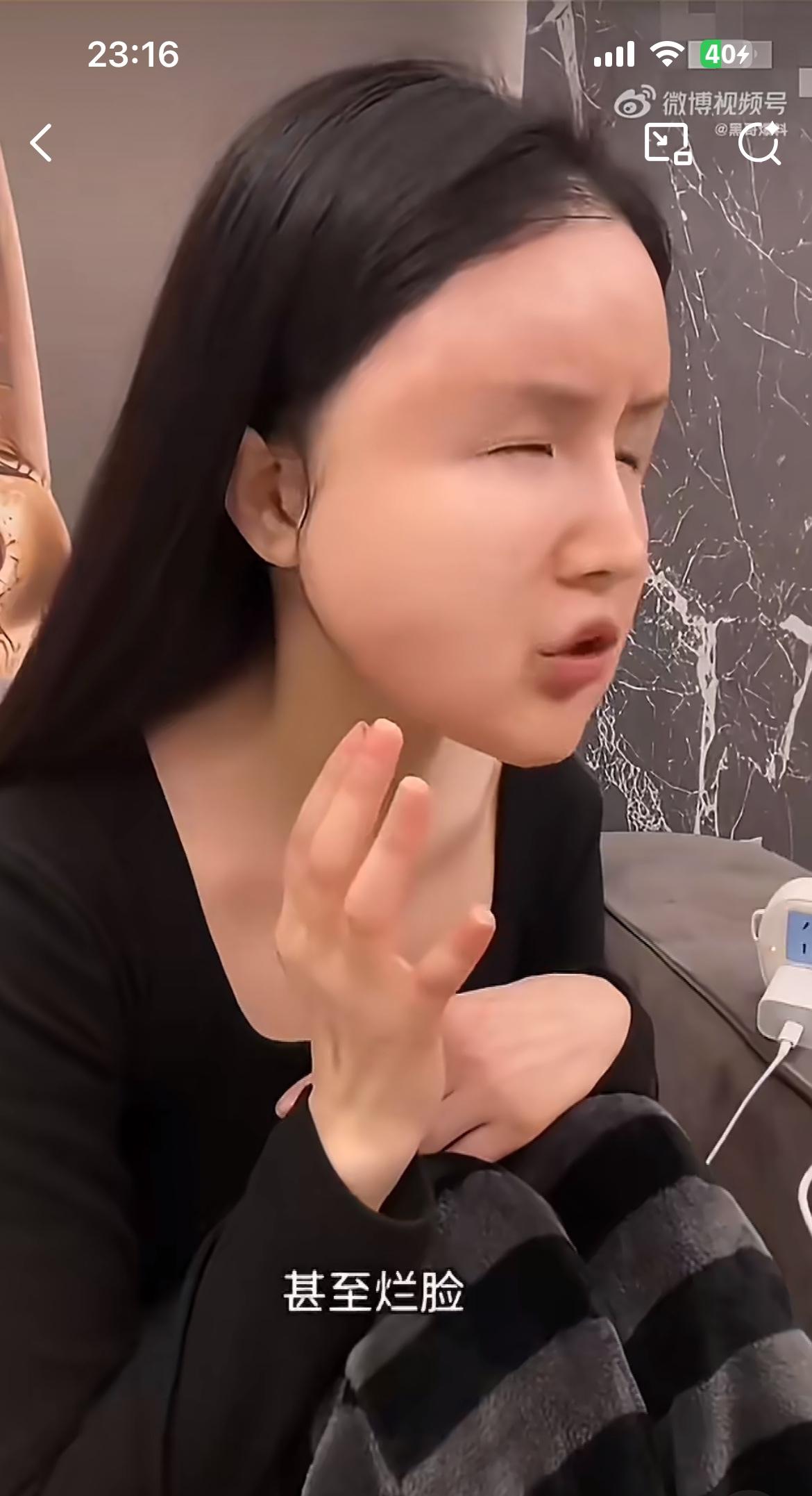 姑娘整容失败，好好的一张脸，肿的像猪头一样。不仔细看，还以为是遭遇了家暴。爱美之