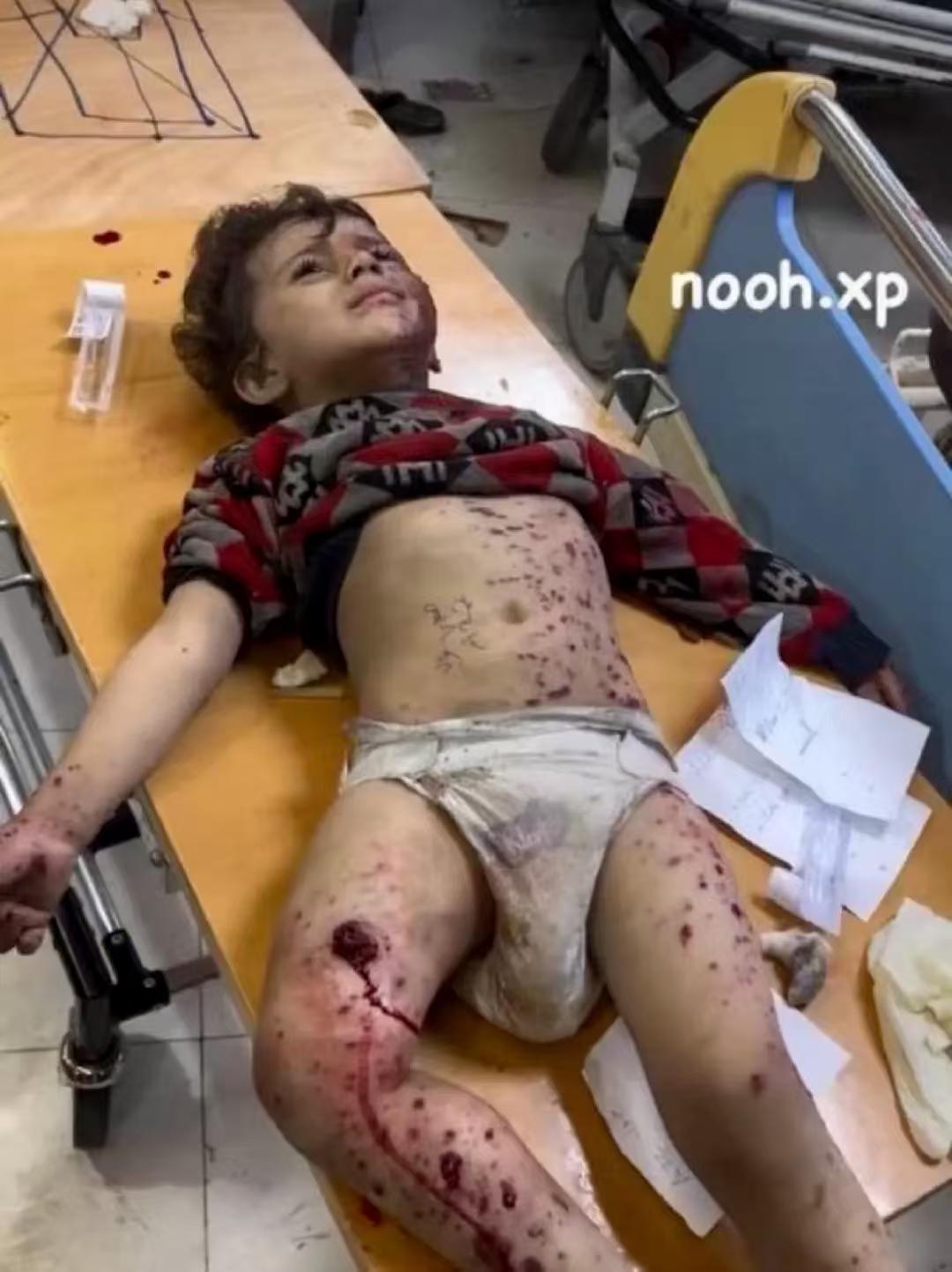 不得不说，以色列是学到了点真东西的！
如何在一个从来没有反犹传统的国家植入反犹主