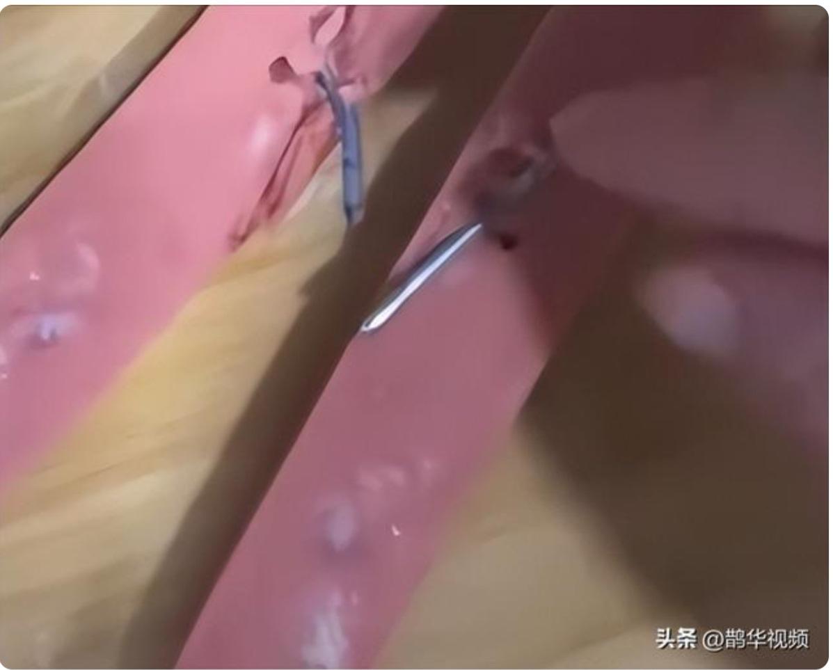 真令人震惊！食品安全无小事，如此严重的异物问题，暴露出生产环节的监管漏洞。
所幸