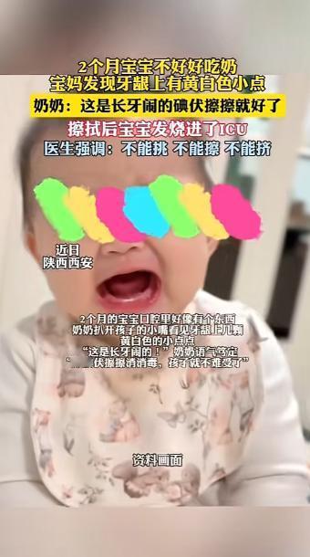 “悲剧还是发生了！”近日，陕西西安，一女子发现自家孩子牙龈上有几颗黄白小点，孩子