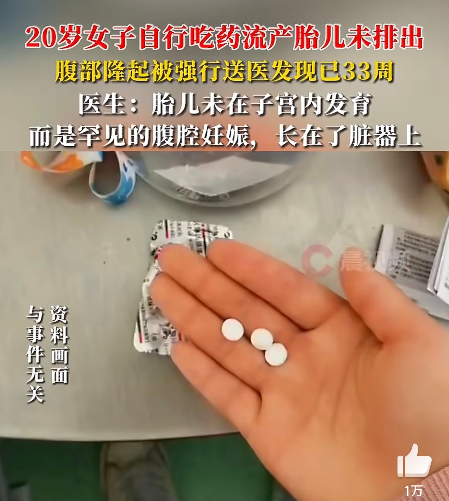 女子药流后腹部隆起才发现胎儿未排妈呀！命中该有孩子怎么都会有！这孩子生命力是够顽