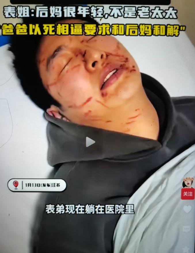 万万没想到！一小伙满脸脖子全身是抓伤！




一小伙最近可是真够倒霉的，满脸、