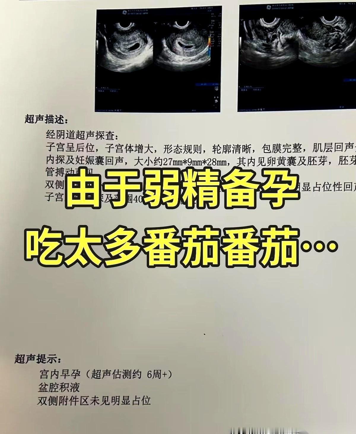 连着啃了几个月的生番茄，拿到化验单那一刻，我老公盯着上面的“21%”，捏着纸的骨