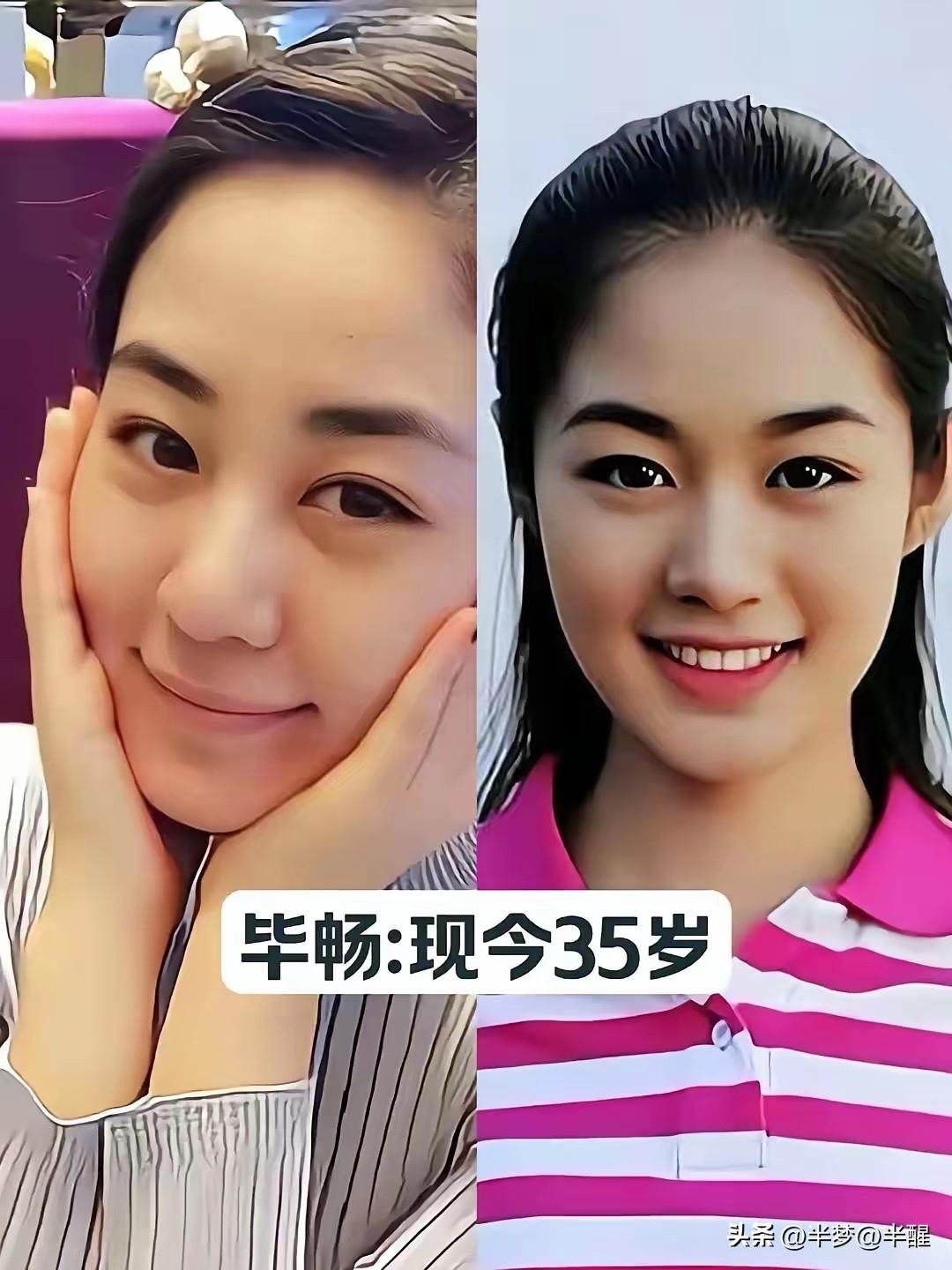 赵家班一众亮眼女演员今昔对比，满满乡村剧回忆

喜剧大师赵本山门下走出不少实力女