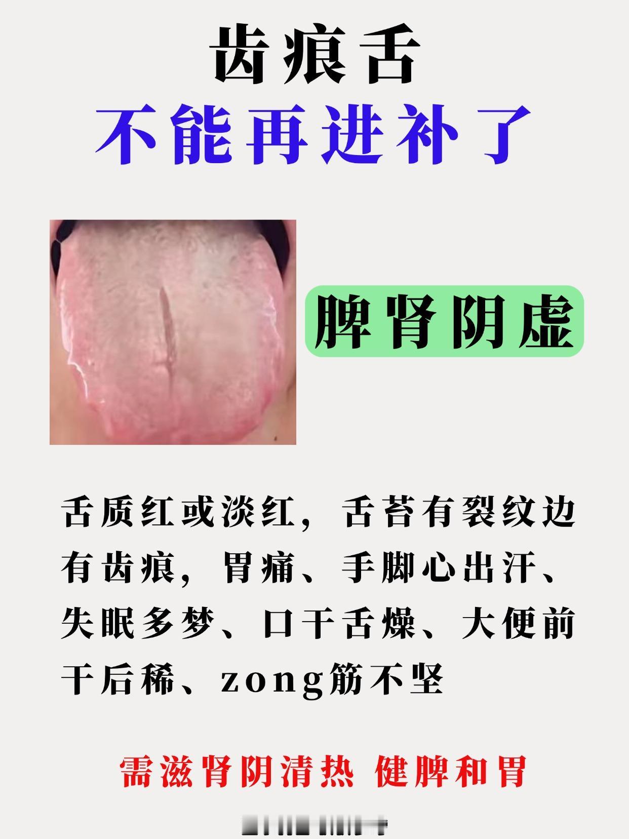 今天周一我值班！继续给大家看800位患者的舌象！一个不漏统统看完！