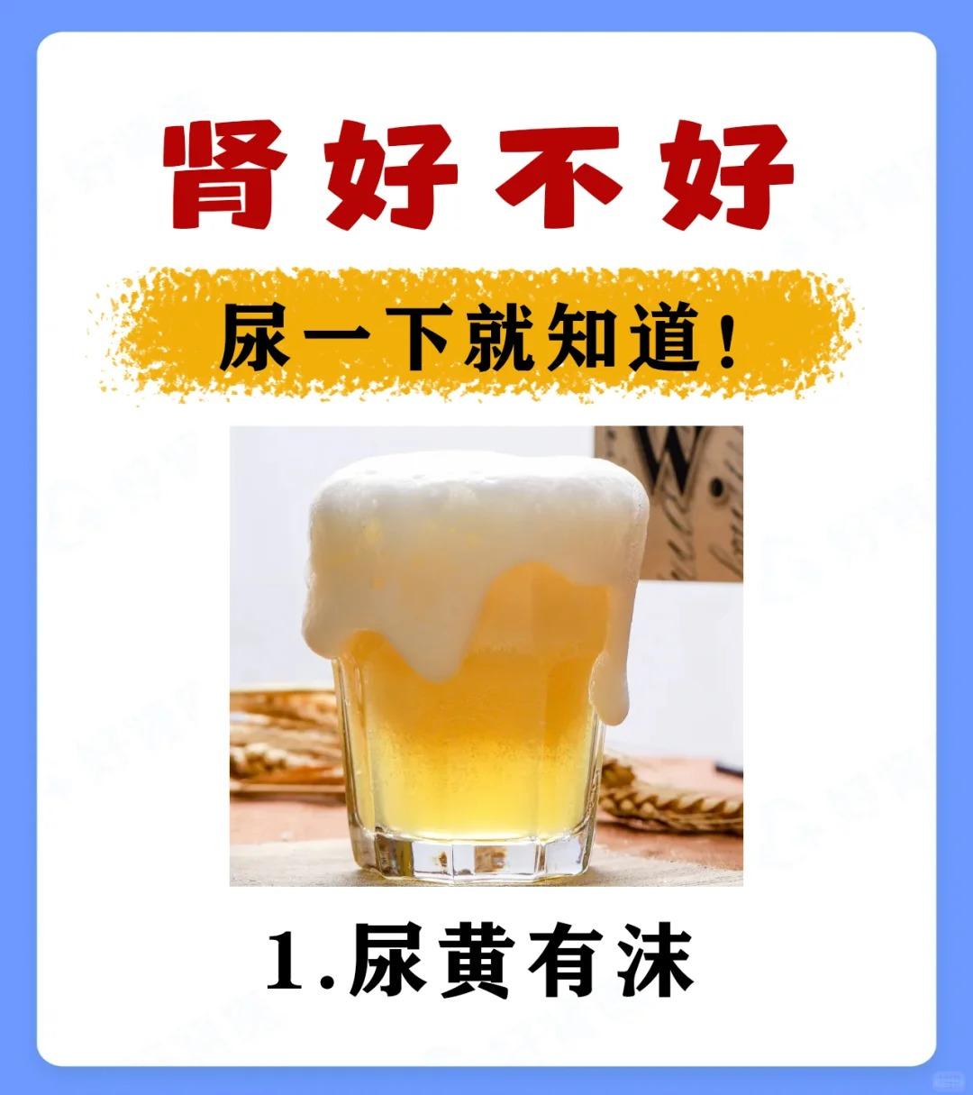 这3个尿尿的秘密，男女都要了解！