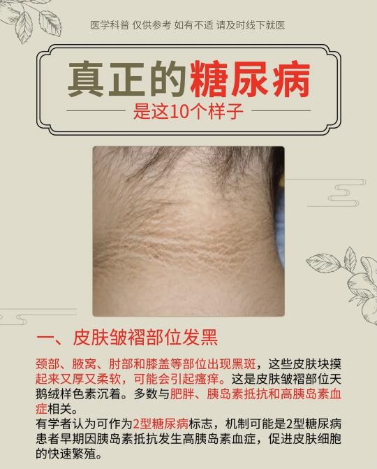 糖友