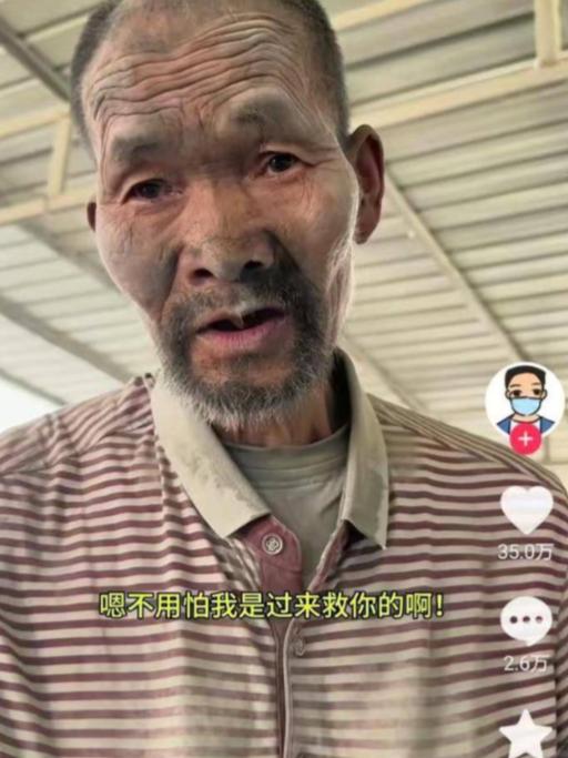 触目惊心！上官正义曝光！

河北保定，一名70多岁的残障老人被水泥经销商长期控制