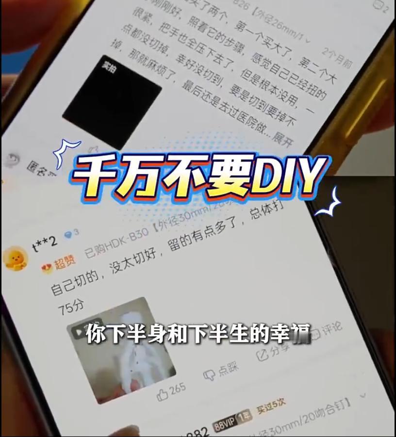 一名24岁的小伙子，大学毕业后独自在上海打工，一直被包皮问题反复困扰，时常发炎难