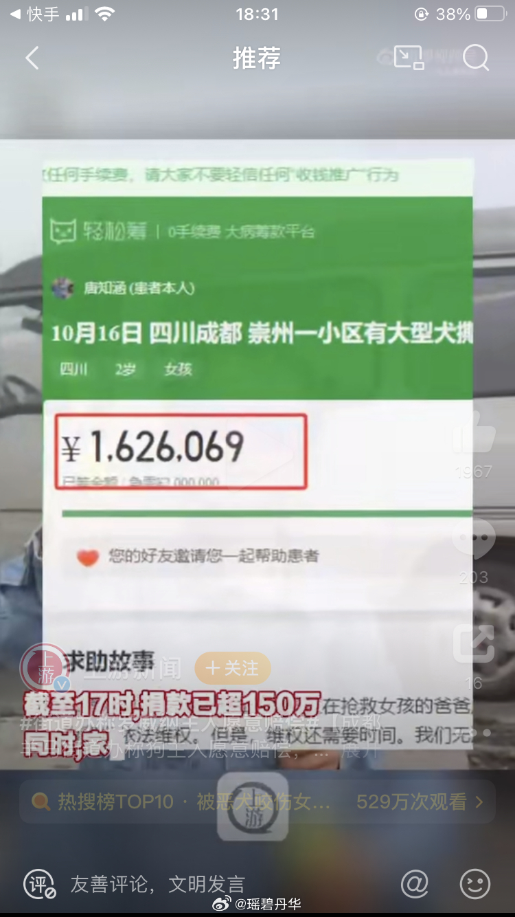 #咬伤女童黑狗的主人被刑拘#下午看到咬伤女童的家人表示狗主人唐某到现在还没道歉；