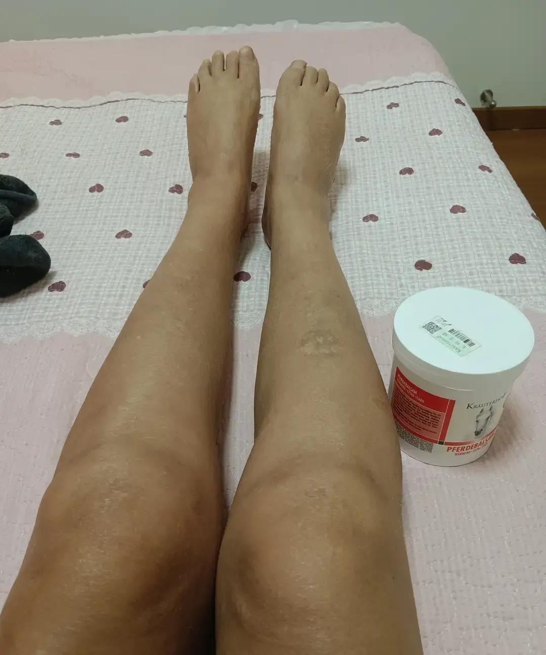 刷到个健身博主早上七点准时打卡半月板康复，直抬腿空中蹬车一套做完还拿马膏自己抹，