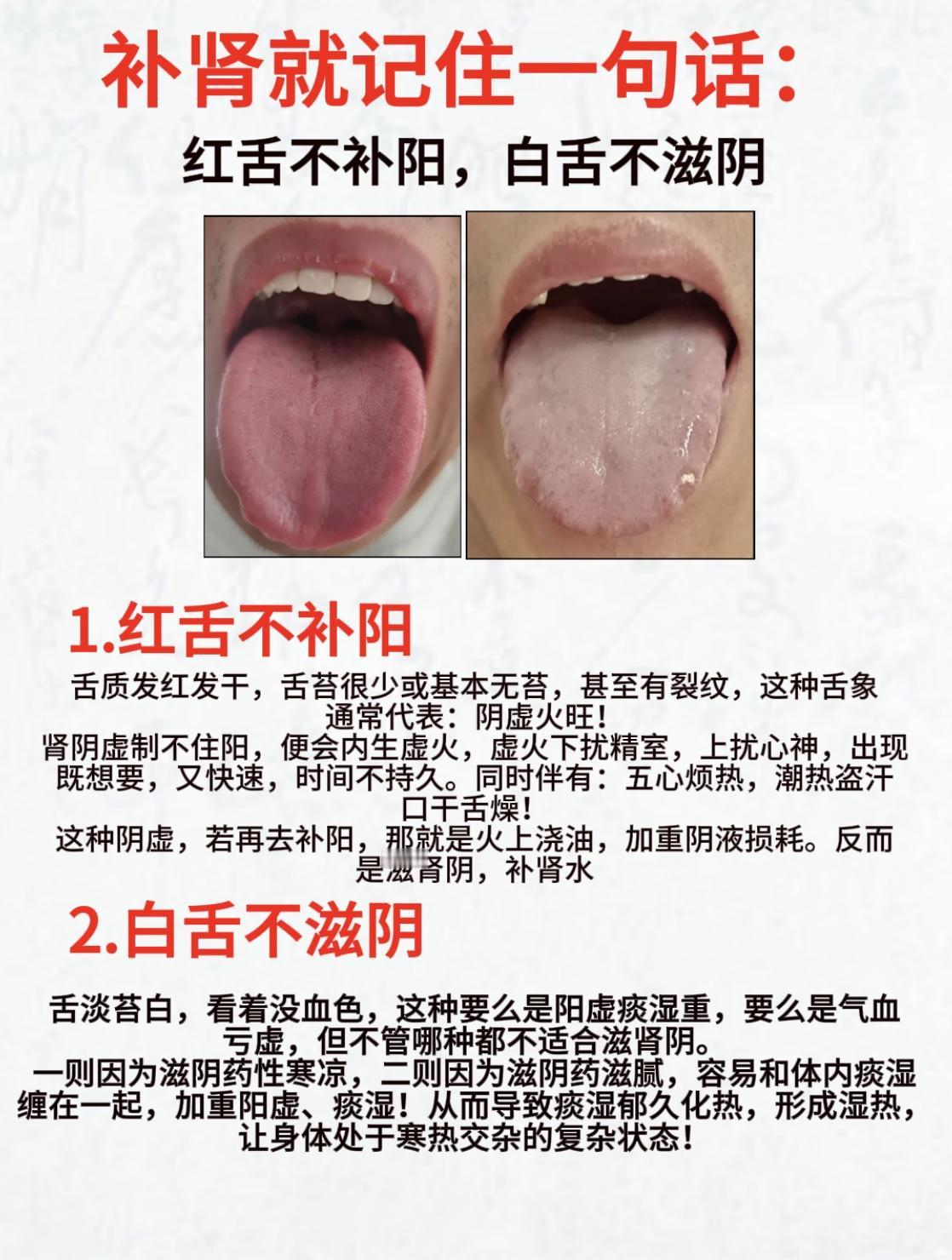 补肾就记住一句话，帮你精准补到位！（红色不补阳，白色不滋阴）
#健康##中医##