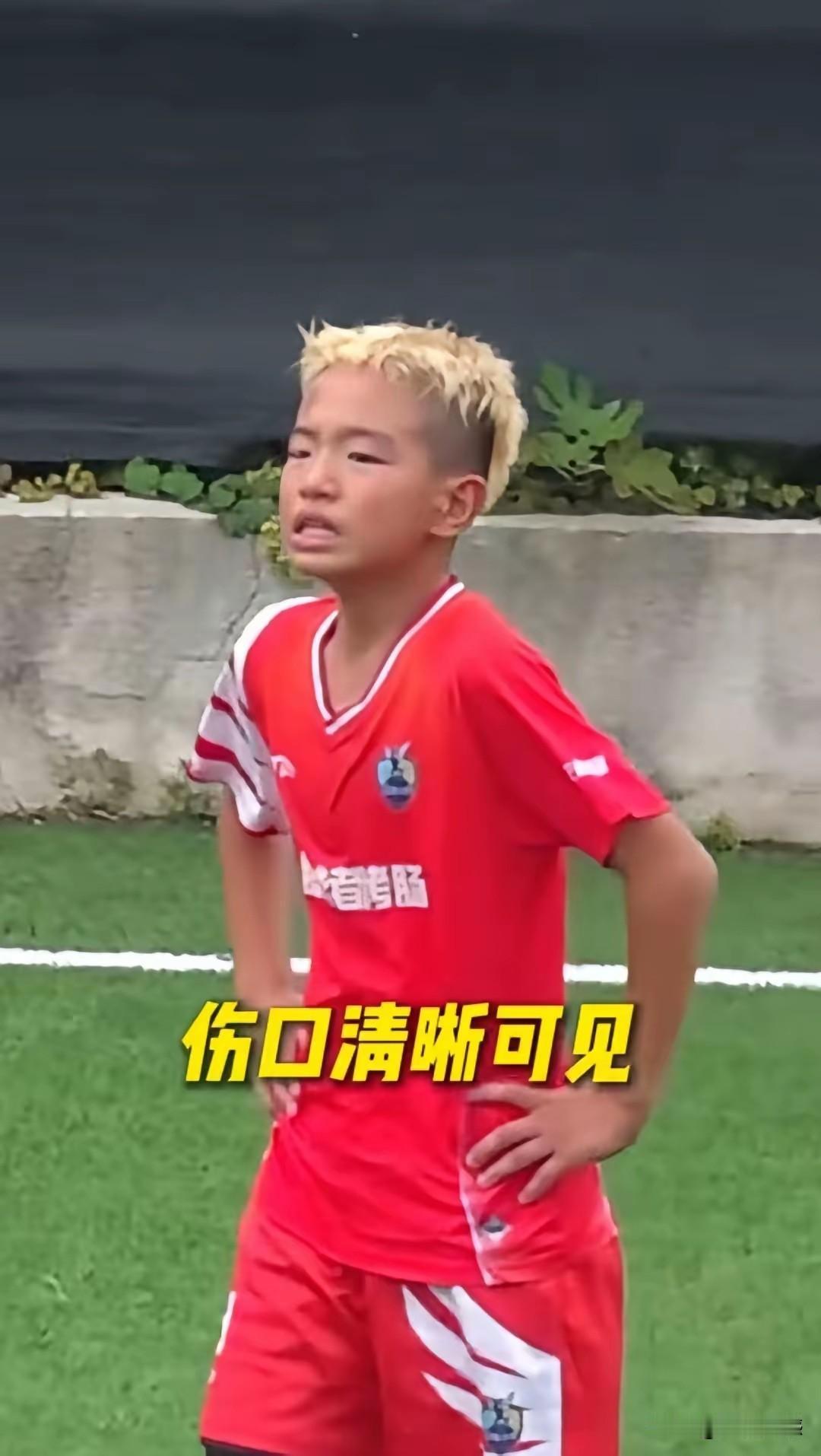 这个足球小将相当的勇敢，在赛场上的表现可圈可点，是个难得的足球好苗子。但是有一个