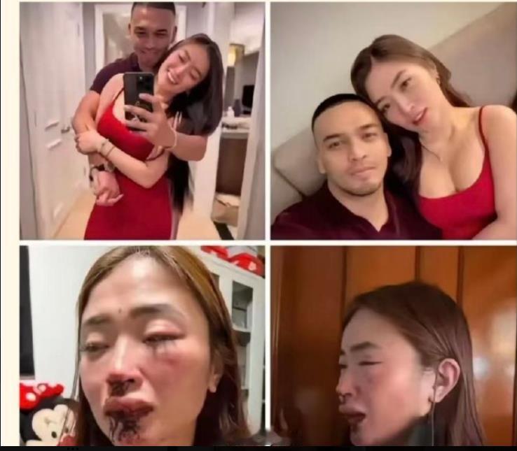西药挺猛的，不仅起效快，还标本兼治。 