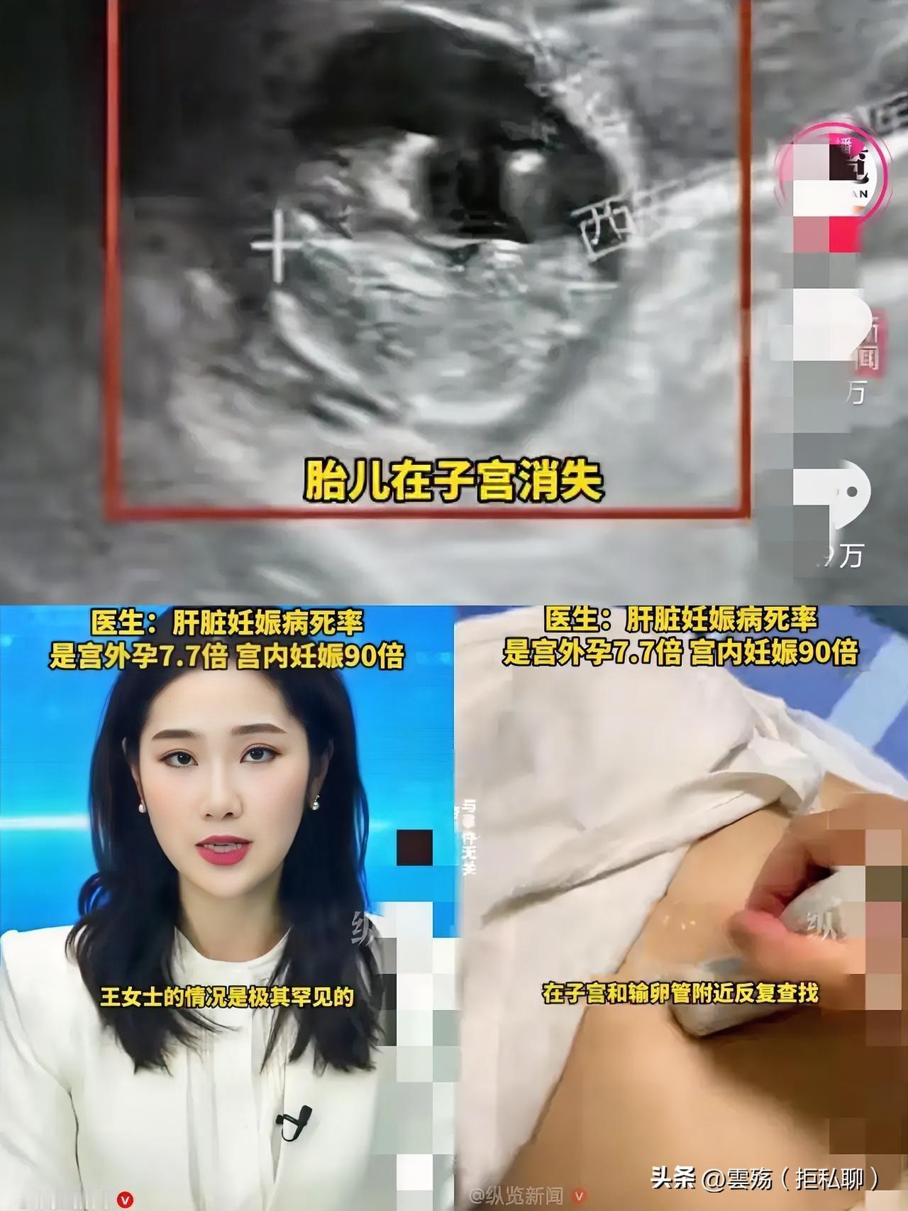 “彻底解释不清了！”

40岁女子停经50天后，抽血显示怀孕，但做B超时，医生在