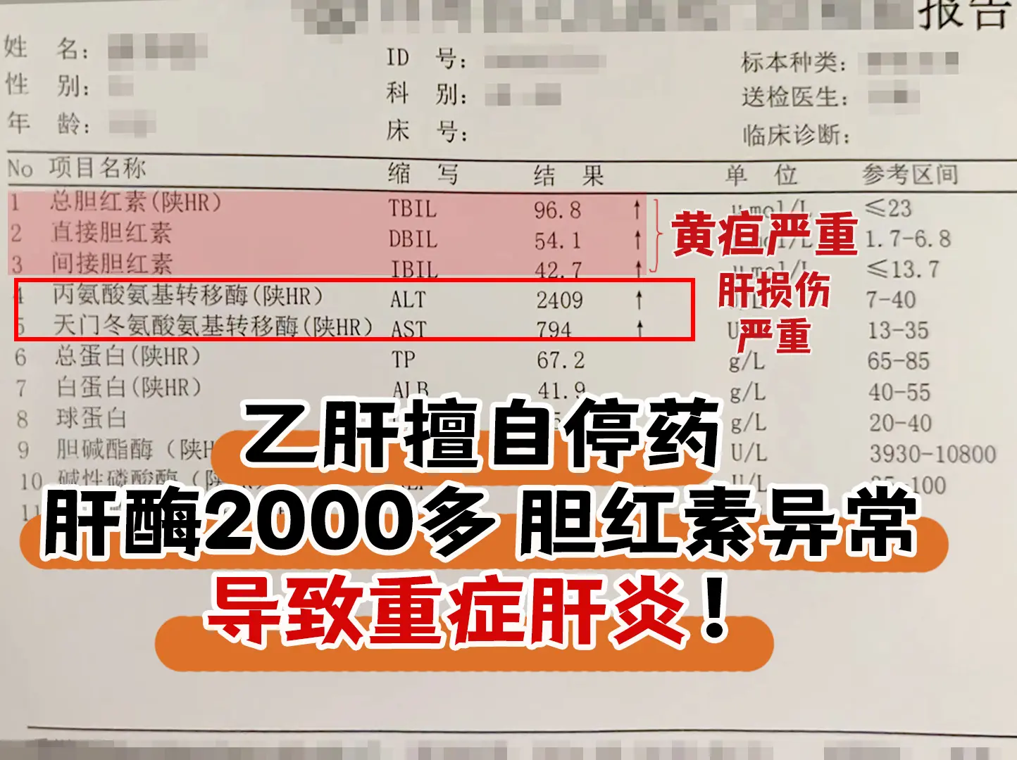 乙肝擅自停药，肝酶2000多，胆红素异常，导致重症肝炎。  这是一位山...