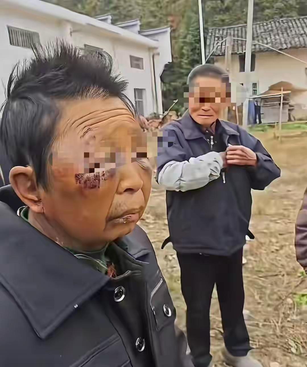 湖南平江一妇女遭丈夫多次家暴住院，出院后继续挨打？当地妇联：多部门介入调查，伤者