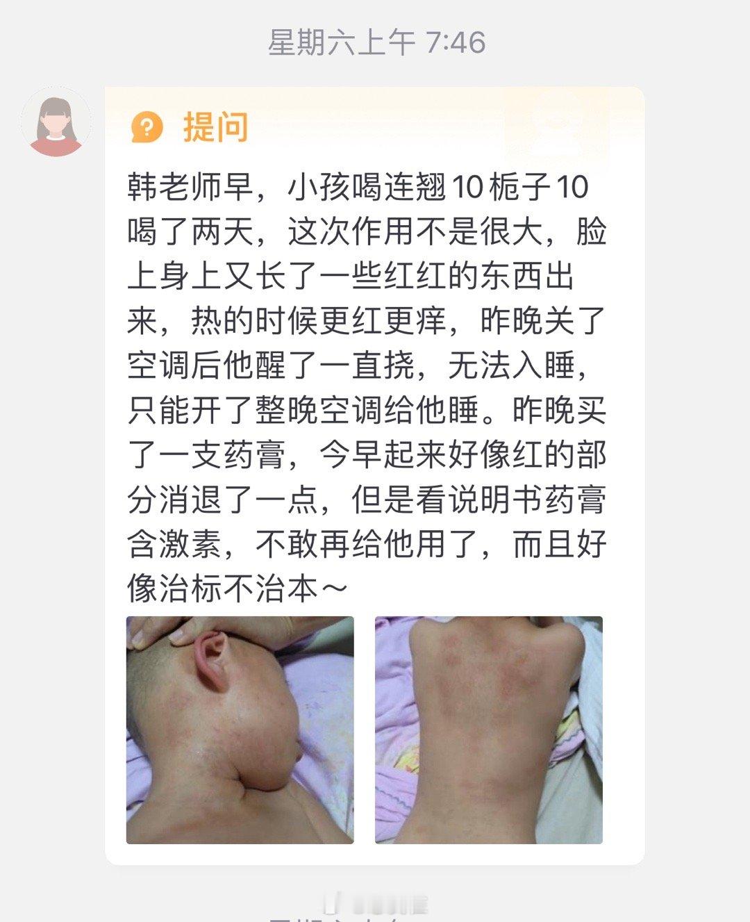 小儿热盛发于皮毛，承气汤，釜底抽薪法。病无大小，得其正治，乃得其环中。 ​​​