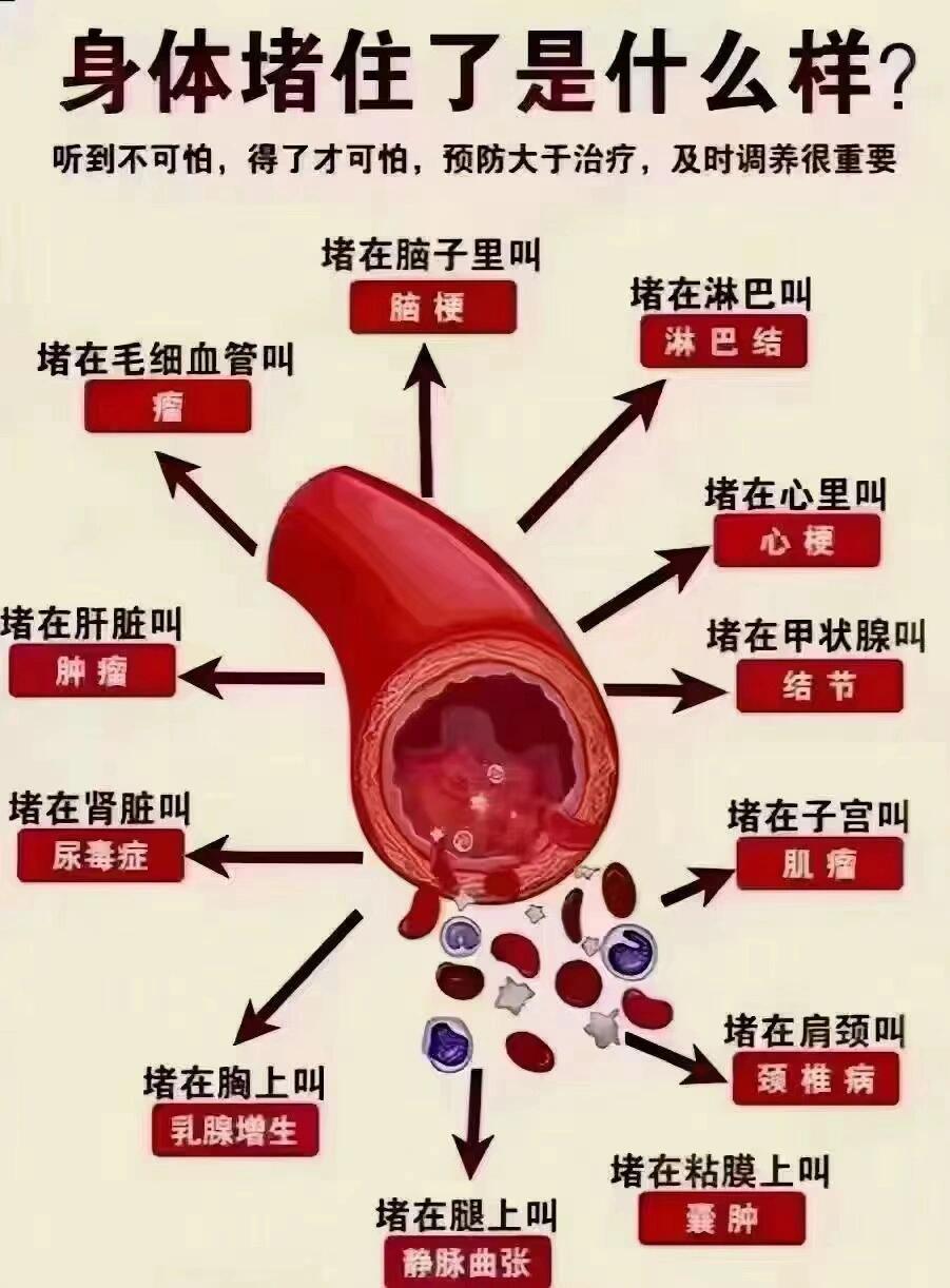 身体堵住了是什么样？听到不可怕，得了才可怕,预防大于治疗，及时调养很重要
心脏的