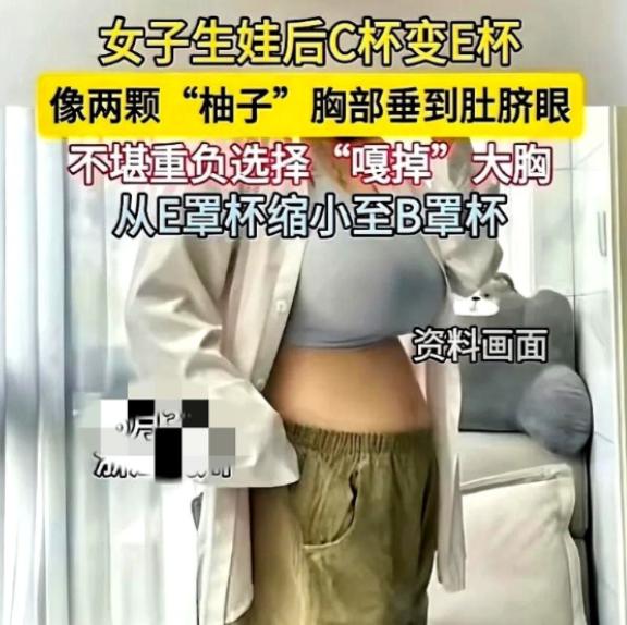 杭州，32岁赵女士长期被胸部过大困扰。夜里她解开内衣，肩上的勒痕深红醒目。丈夫心