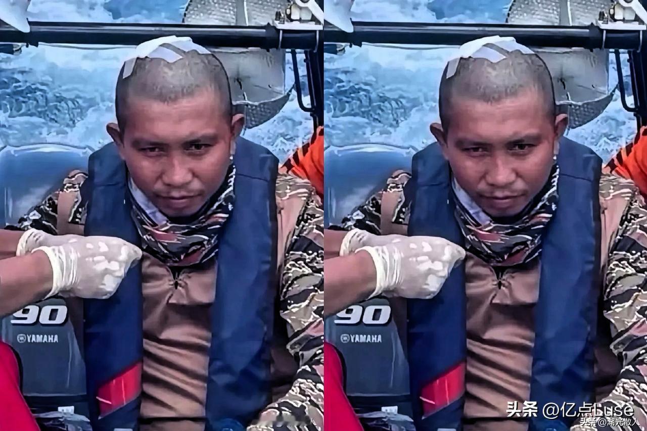 这位便是被中国海警敲破脑袋的菲律宾军人，竟成“英雄”了。不过是一点皮外伤，连轻伤