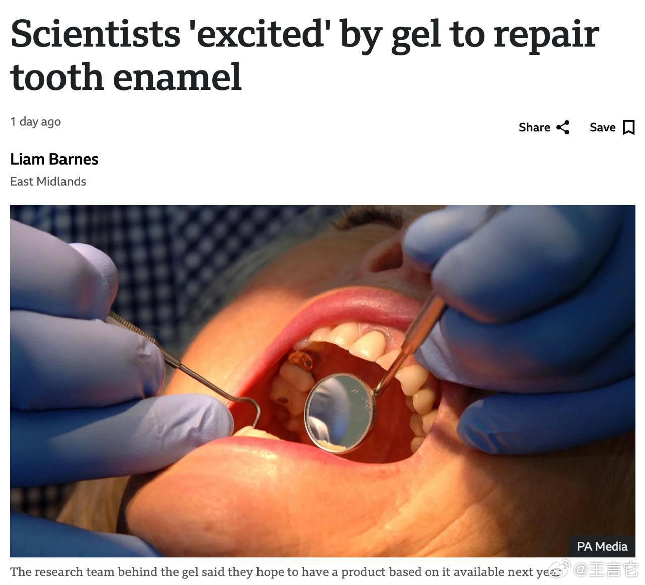 🦷 蛀牙可能很快就会成为历史！科学家们研制出一种可以修复牙釉质的凝胶。    
