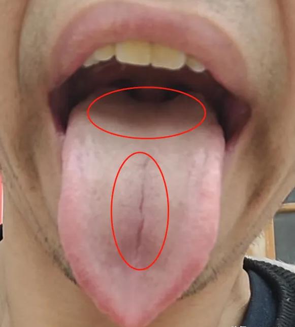 男科不给力，“上车难”、“下车快”，身体乏力、筋疲力尽，干什么事都没有精神，但无