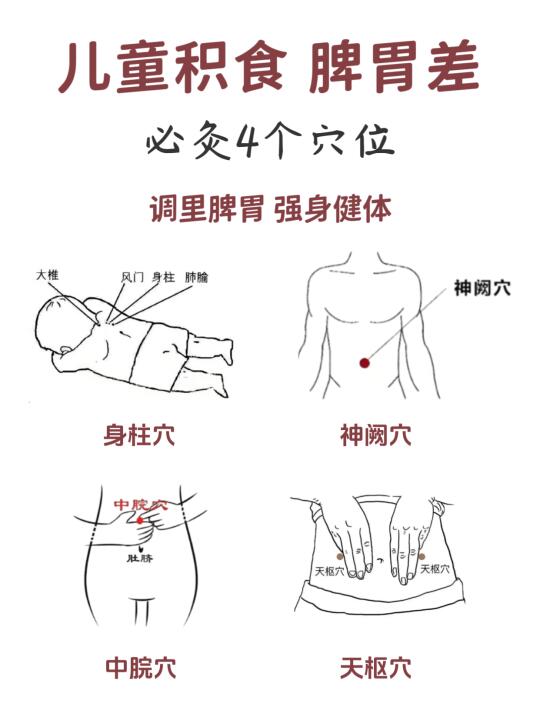 宝妈必知❗儿童积食脾胃差，灸这4个穴位