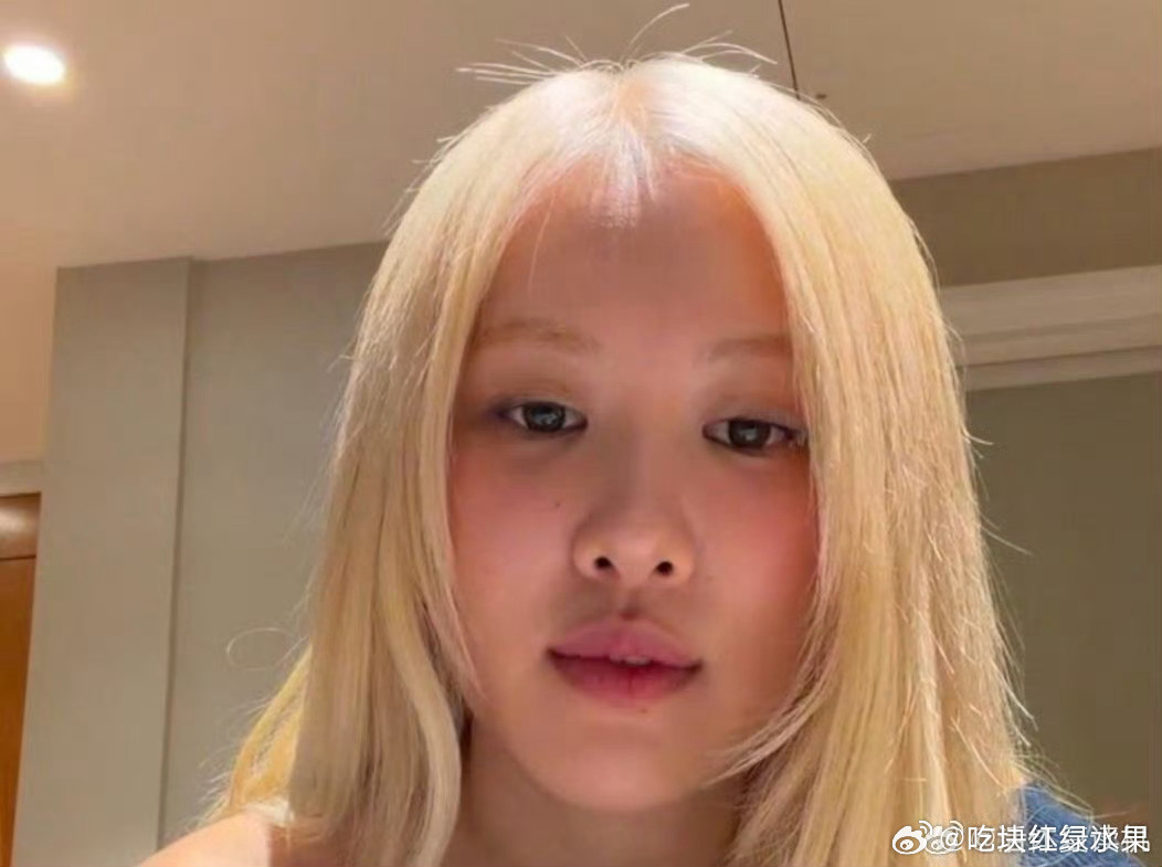 ROSE坦言 自己的头皮好像因为过度漂发受损了 