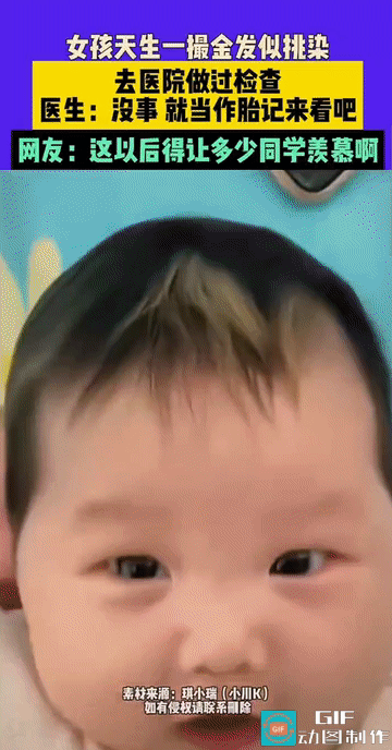 “这就是天选之女吗？”近日，广东一名2岁半的女孩因天生拥有一撮犹如“挑染”般的金