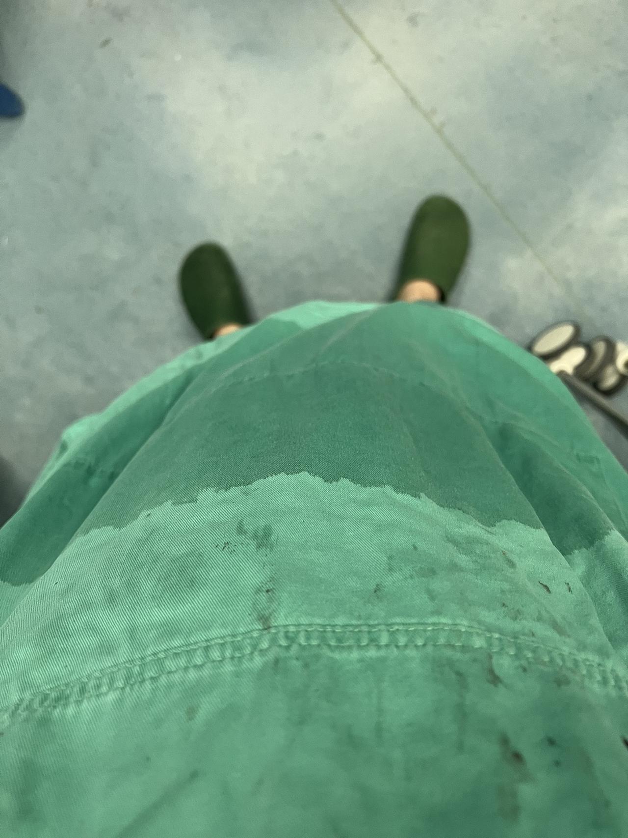 急诊手术做完了，又湿身了