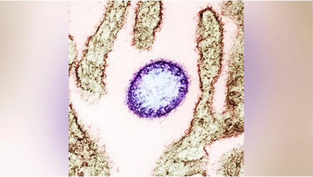 印度尼帕病毒疫情爆发后，马来西亚加强入境