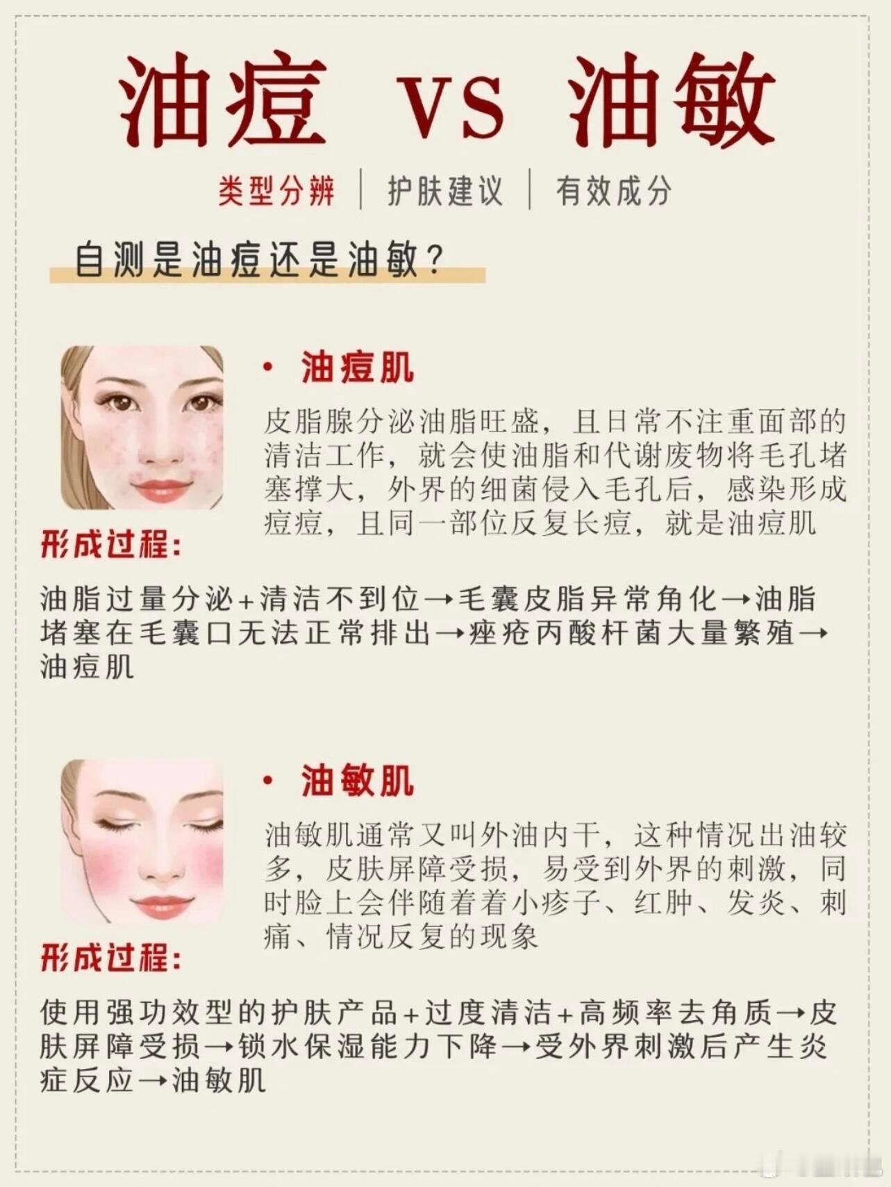 油痘还是油敏？ 油痘肌：脸易出油且常爆痘，核心问题是长痘。油敏肌：脸部出油同时皮