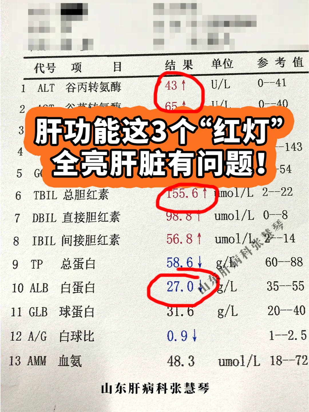 肝功能上这3个“红灯”全亮，肝脏有问题！