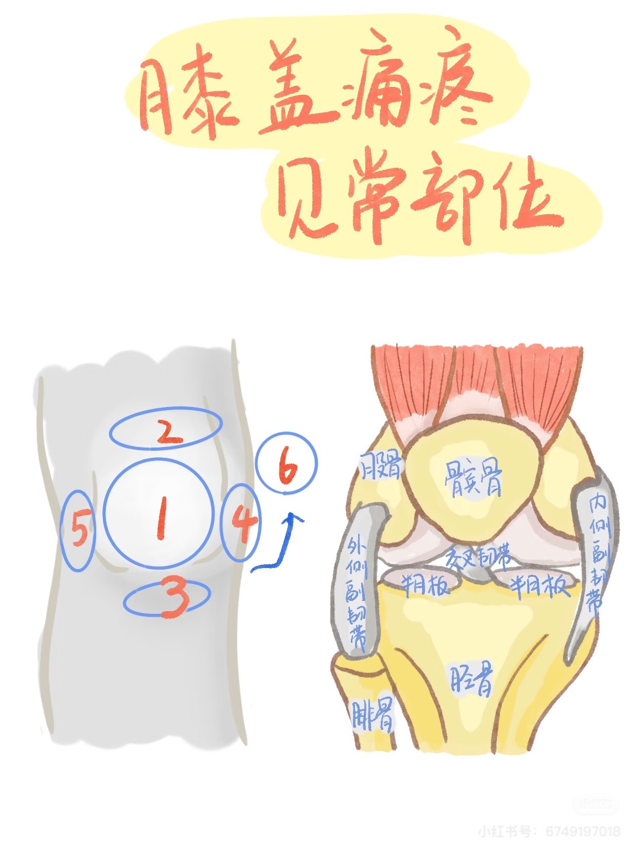 膝关节损伤 今天继续聊膝盖疼痛——常见部位及可能原因👇🏻👇🏻01【膝盖前