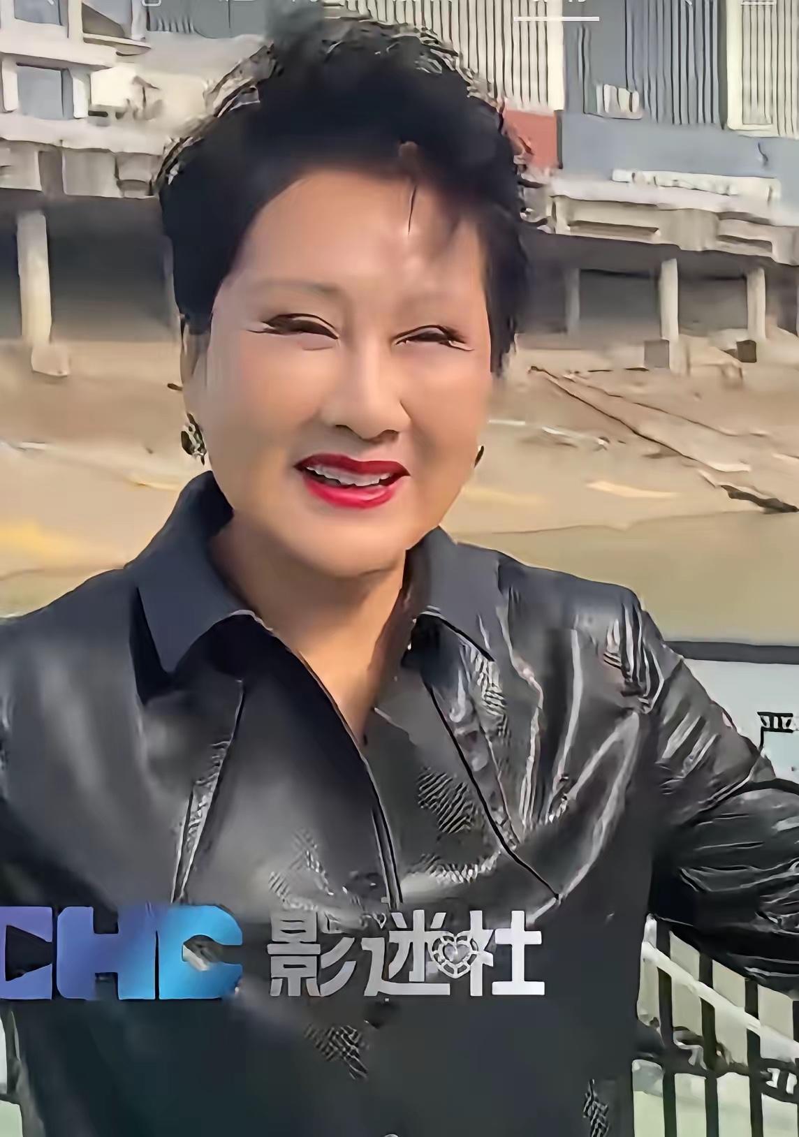张凯丽这波真的折腾过头了！
整张脸绷得紧紧的，肿得快认不出，完全没了当年《渴望》